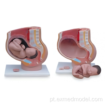 Pélvis feminina com feto
